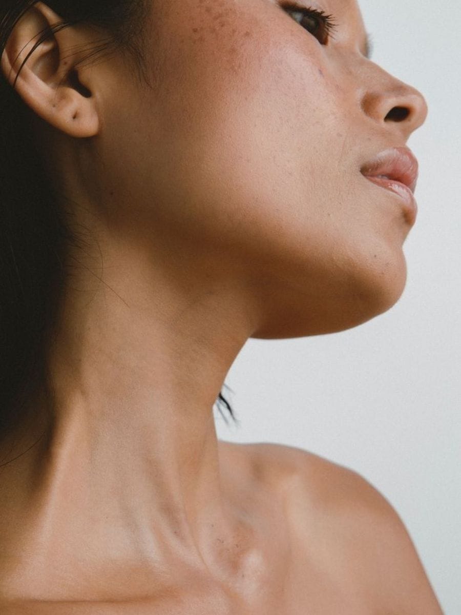 Profil von Gesicht, Hals und Dekolleté mit ebenmäßiger Haut – RedTouch PRO bei Evelina Aesthetic Concept Kö